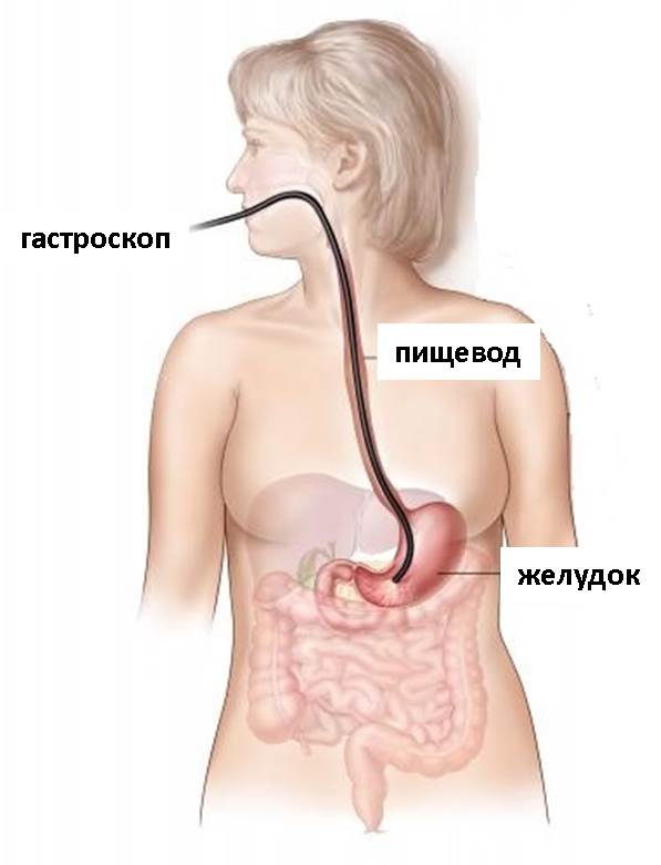 Что такое гастроскопия?