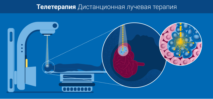 Терапия